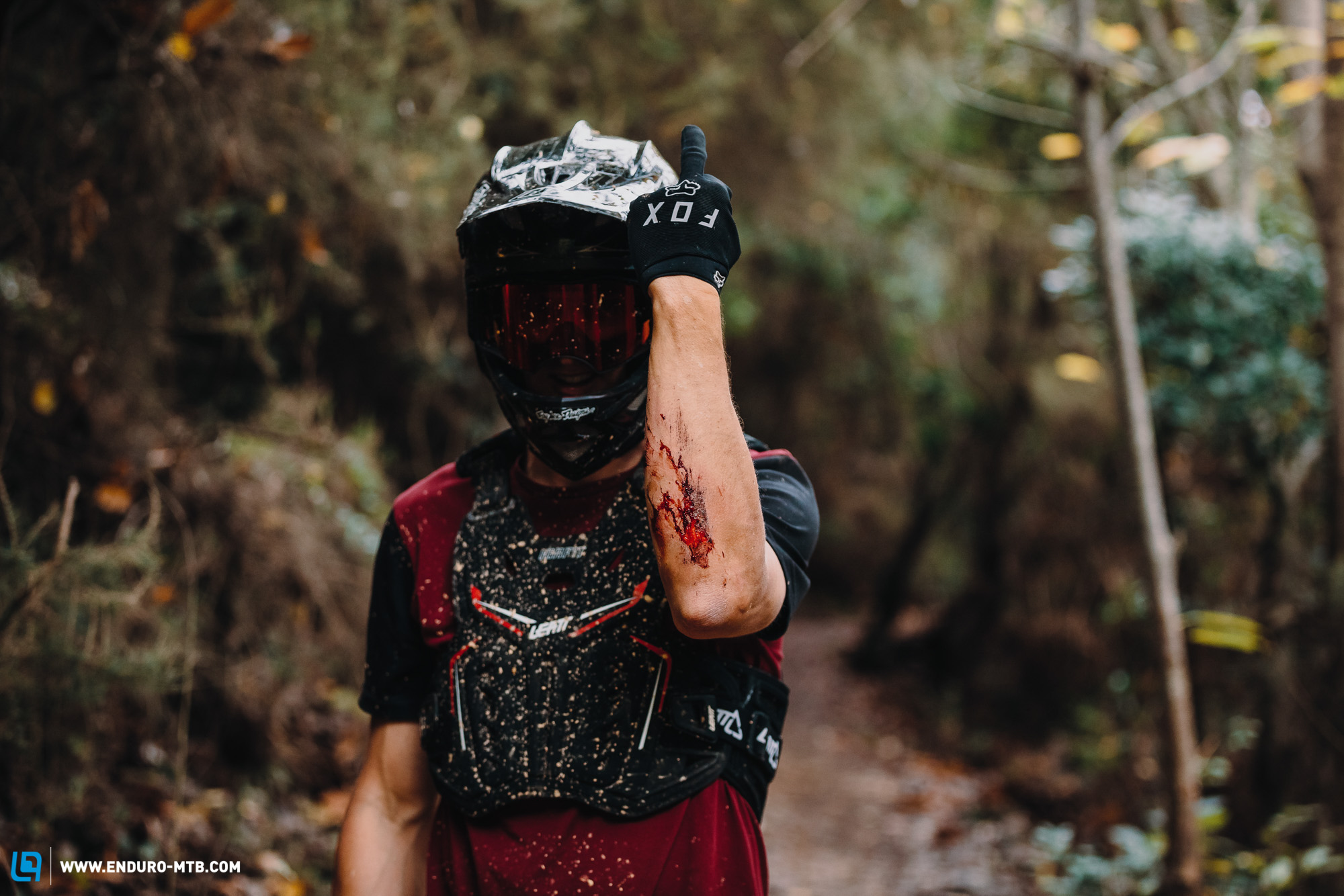 The ultimate mountain biker’s guide to first aid
